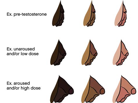 trans bottom growth meaning|Bottom Growth and Genital Changes on Testosterone